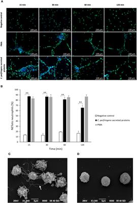 Clostridium perfringens phospholipase C, an archetypal bacterial virulence factor, induces the formation of extracellular traps by human neutrophils